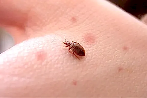 tahtakurusu ilaçlama izmir